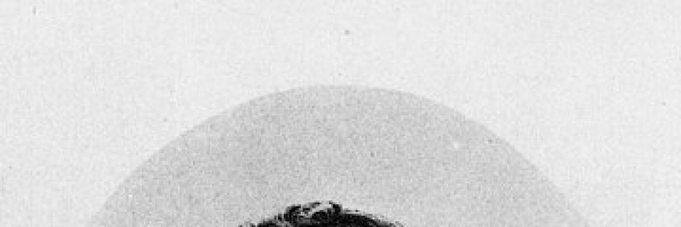 peto